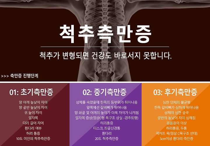 광주척추측만증 초기증상을 확인해보세요! 6